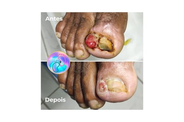 Foto de antes e depois do tratamento 27